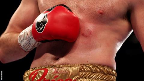 Outrageous: Boxer, Kash Ali penalized heavily for biting David Price